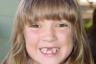 Callie lost her bottom tooth now!