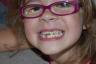 Look how the top tooth is just hanging