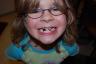 Julia after getting her four teeth pulled - OUCH!