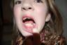 Callie lost her first molar